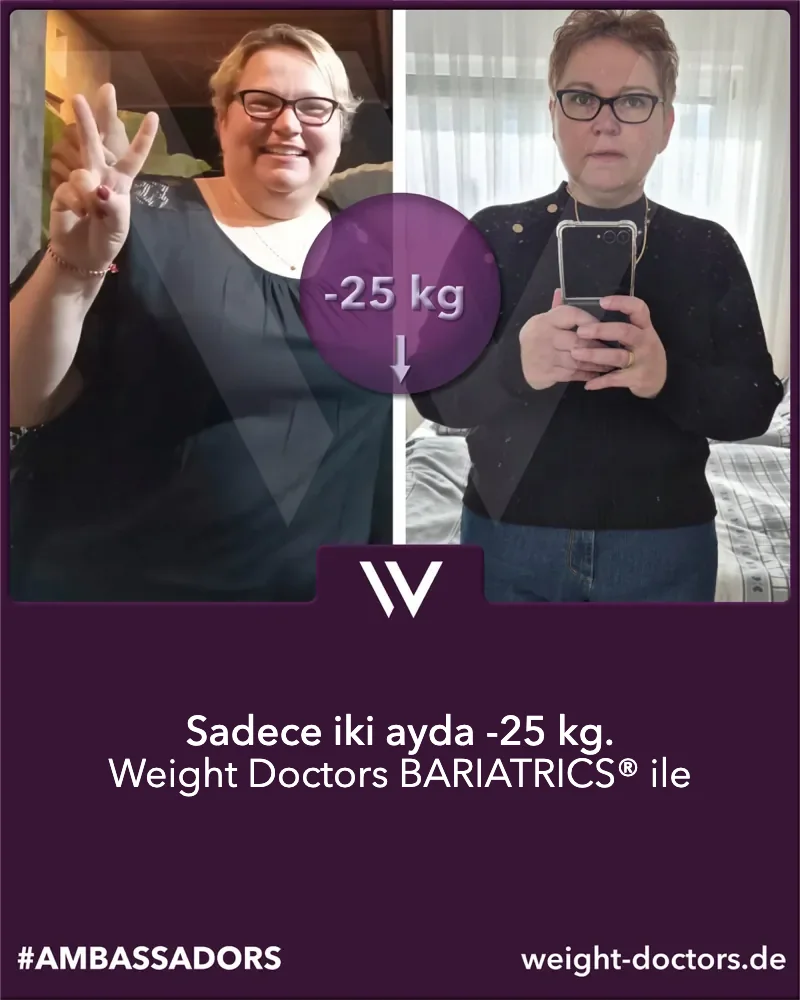 Weight Doctors® öncesi ve sonrası: Weight Doctors BARIATRICS® ile iki ayda 25 kg daha az olan kadın hasta