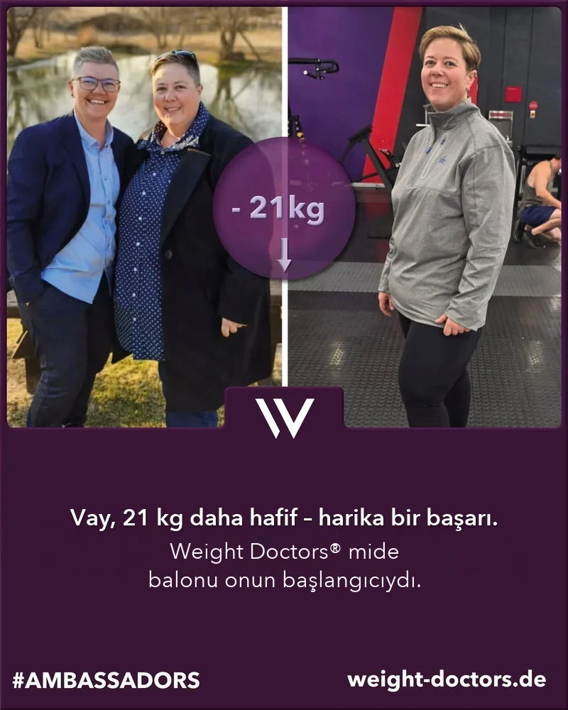 Weight Doctors® öncesi ve sonrası: Weight Doctors® MİDE BALONU ile 21 kg daha az olan Elli